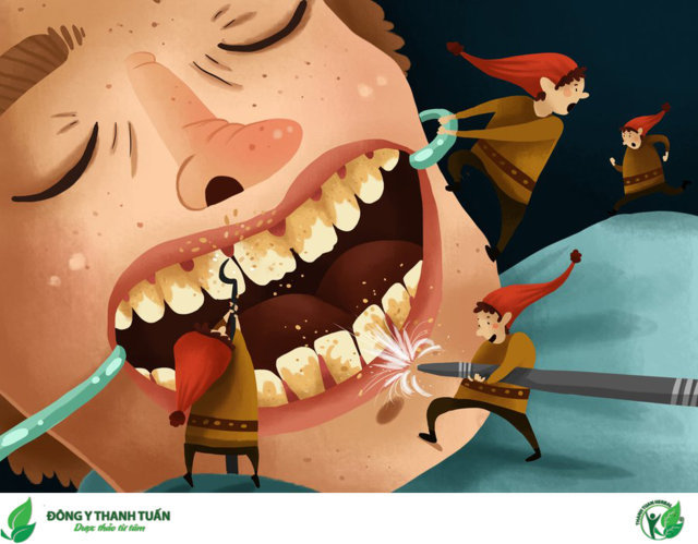 Điều trị sâu răng tại nha khoa